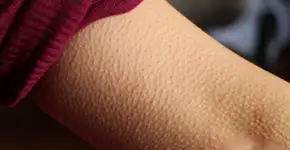 Foto: (Hailshadow/istock)