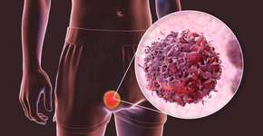 Foto: (iStock/Dr_Microbe)