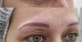 Mulheres em tratamento de câncer ganham tatuagem cosmética