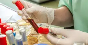 Exame de sangue pode detectar risco de 19 tipos de câncer