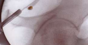 Foto: (choicegraphx/istock)