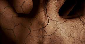 3 máscaras caseiras para recuperar a pele após o verão