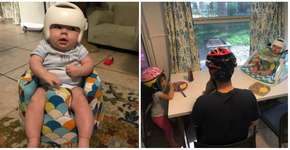 Menina cria estratégia para que o irmão não se sinta diferente