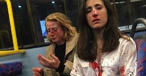 Grupo espanca casal de lésbicas e exige que elas se beijem