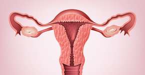 Estudo descobre condição que favorece o risco de câncer de útero