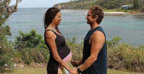 Lembra dela? Modelo que teve o corpo queimado registra a gravidez