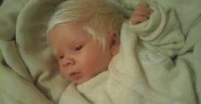 Bebê faz sucesso ao nascer com o cabelo todo branco no RS