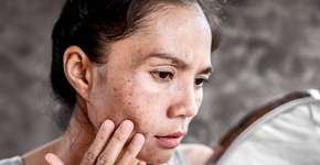 Este erro comum pode acelerar o envelhecimento da sua pele, segundo médico