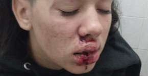 Lésbica é espancada em Praia Grande