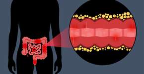 Foto: (Pikovit44/istock)