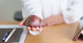 Foto: (iSTock/Panuwat Dangsungnoen)