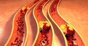 Foto: (Depositphotos/ralwel)