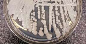 Foto: (reprodução/CDC)