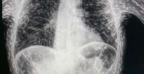 Foto: (reprodução/Twitter/vitorborin_)