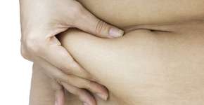 Você pode ganhar até 5 kg com inchaço em um dia