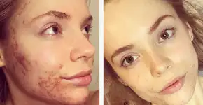 Foto: (Imagem sem texto alternativo disponivel ID [1360857])