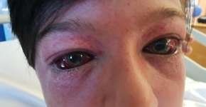 Menino participa de desafio viral e fica gravemente ferido