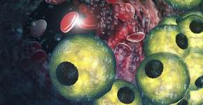 Foto: (EzumeImages/istock)