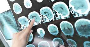 Foto: (sudok1/DepositPhotos)