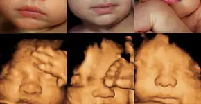 Foto: (reprodução/instagram/sweet3dbaby)