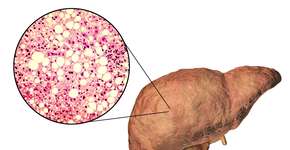 Foto: (Dr_Microbe/istock)