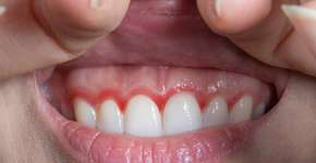 Foto: (sruilk/DepositPhotos)