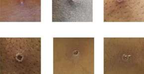 Foto: (reprodução/UKHSA)