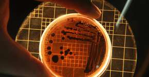 Estes são os 4 vírus mais perigosos do mundo