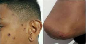 Foto: (Imagem sem texto alternativo disponivel ID [1544306])