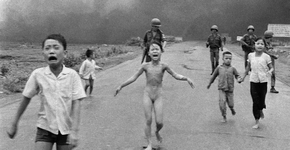 ‘Garota Napalm’, da famosa foto na Guerra do Vietnã passa por último tratamento de pele 