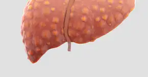 Foto: (luismmolina/istock)