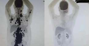 Foto: (Reprodução/Instagram @paulocfperegrino)