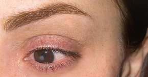 Foto: (reprodução/Instagram/limelchert)