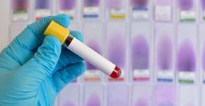 Foto: (jarun011/istock)