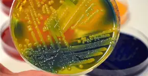 Superbactéria é detectada no Nordeste e representa risco global de saúde