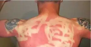 Galeria de fotos traz banhos de sol mal sucedidos