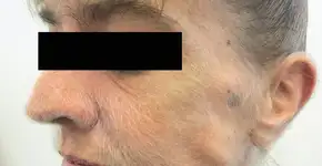 Foto: (New England Journal of Medicine)