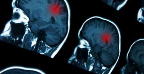 Foto: (goglik83/istock)