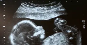 Entenda a ligação entre idade dos pais e chances do filho nascer com autismo