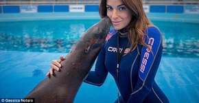 Miss atacada com ácido faz selfie pela primeira vez