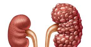 Foto: (lightsource/DepositPhotos)