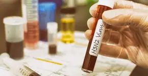 Fake News: vírus da gripe H3N2, que castigou EUA, chega ao Brasil