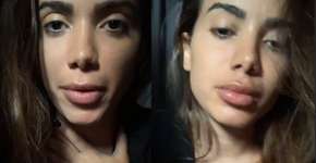 Aprenda com a Anitta 8 dicas para não se enganar sobre depressão