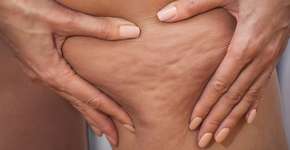 Foto: (Getty Images)