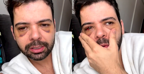 Gustavo Mendes volta atrás sobre assalto e admite: ‘Eu me equivoquei’