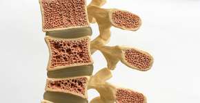 Foto: (Leesle/istock)