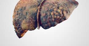 Foto: (eranicle/istock)