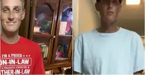 Reação a antidepressivo comum escurece a pele de paciente