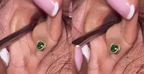 Causa da dor de ouvido desta mulher choca médicos; assista vídeo