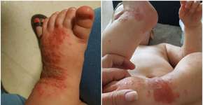 Foto: (Imagem sem texto alternativo disponivel ID [1140224])